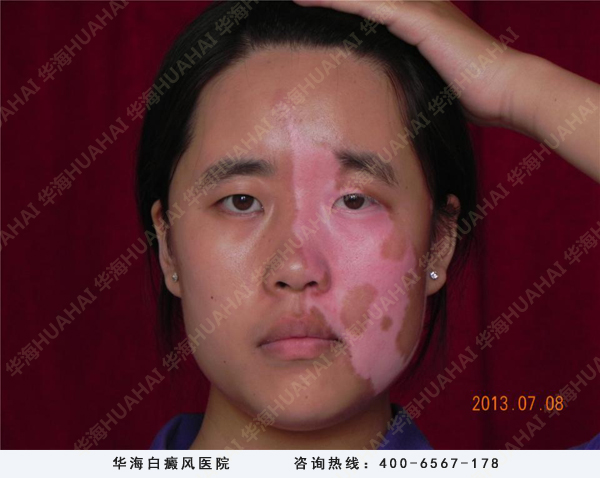 免费救助