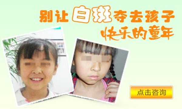 白斑到底是不是白癜风