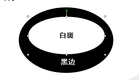 胸部白癜风有哪些症状