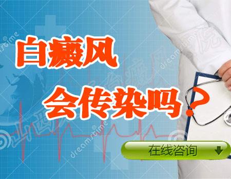 白癜风是否传染？