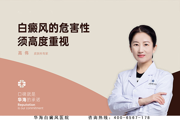 白癜风的危害性须高度重视
