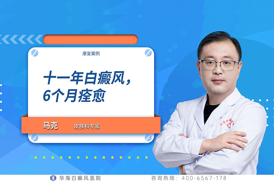 十一年白癜风，6个月痊愈