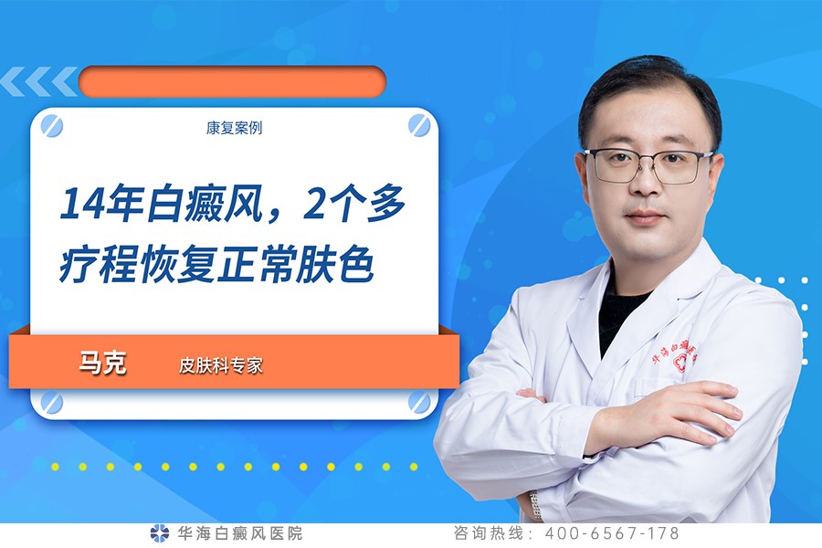 14年白癜风，2个多疗程恢复正常肤色