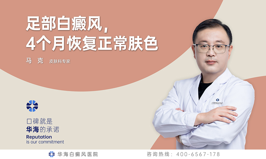 足部白癜风，4个月恢复正常肤色