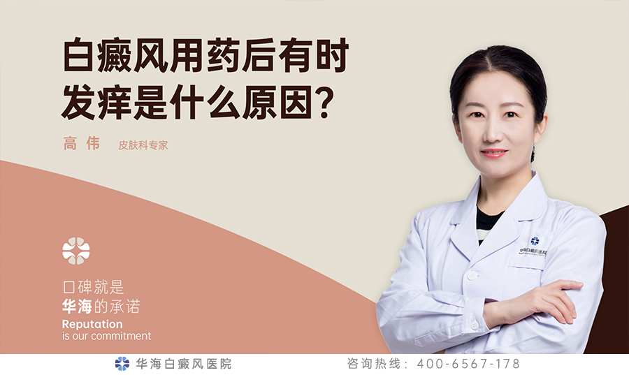 白癜风用药后有时发痒是什么原因？
