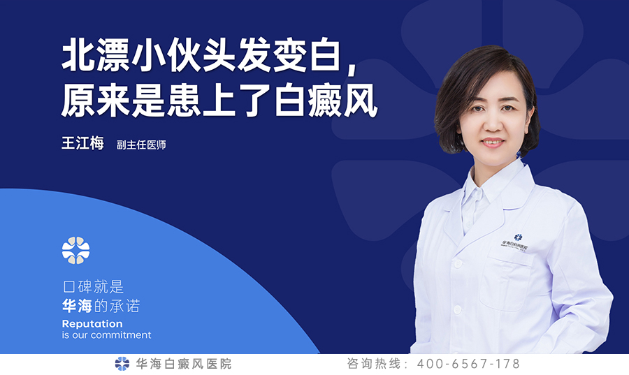 北漂小伙头发变白，原来是患上了白癜风