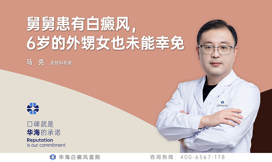 舅舅患有白癜风，6岁的外甥女也未能幸免