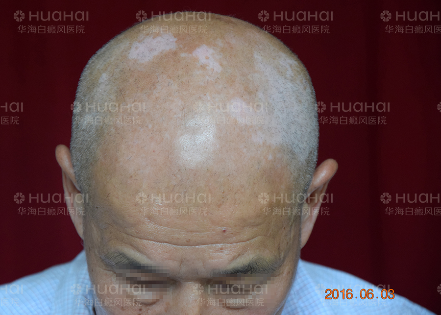 严树兴900-1.jpg