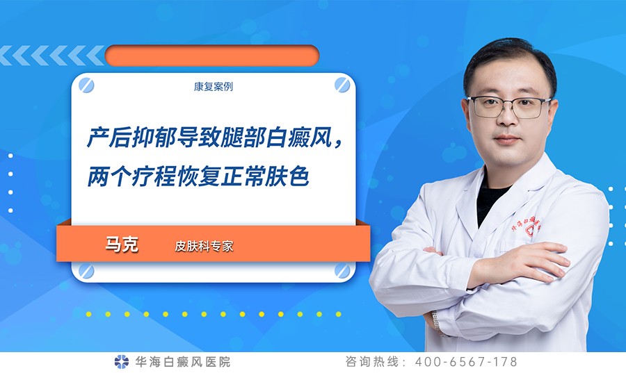 产后抑郁导致腿部白癜风，两个疗程恢复正常肤色