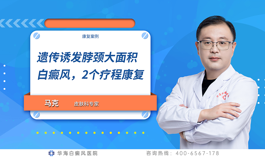 白癜风遗传吗jpg